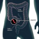 L’appendice ci difende dalle infezioni