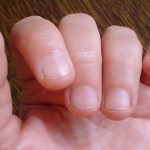 Onicofagia… e le mani perfette?
